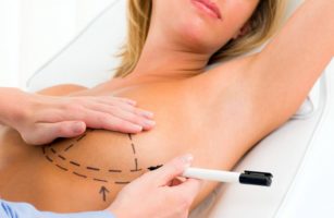 Ученые изучили последствия сохранения груди